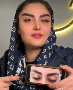 نمونه کاشت ابرو کلینیک زیبایی مریم