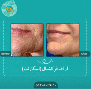 نمونه آر اف فرکشنال کلینیک سلامت ایده آل