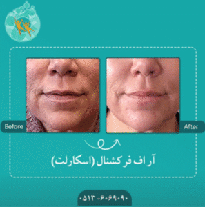 نمونه آر اف فرکشنال کلینیک سلامت ایده آل