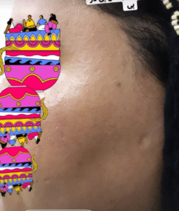 نمونه آر اف صورت دکتر سحر پارسایی