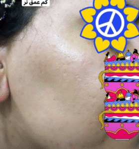 نمونه آر اف صورت دکتر سحر پارسایی