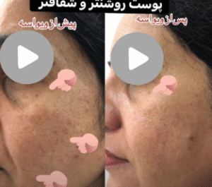 نمونه آر اف صورت دکتر سحر پارسایی