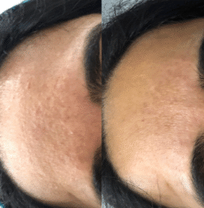 نمونه آر اف صورت دکتر سحر پارسایی