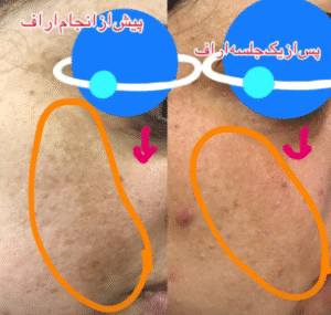 نمونه آر اف صورت دکتر سحر پارسایی