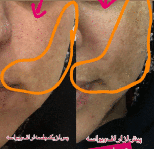 نمونه آر اف صورت دکتر سحر پارسایی