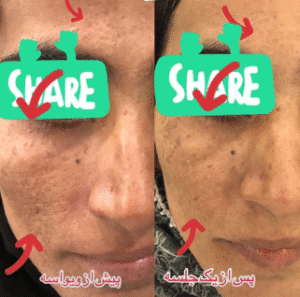 نمونه آر اف صورت دکتر سحر پارسایی