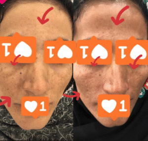 نمونه آر اف صورت دکتر سحر پارسایی