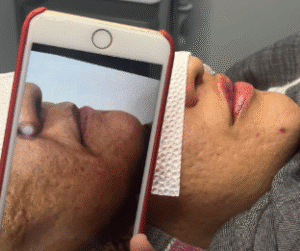 نمونه آر اف صورت دکتر سحر پارسایی