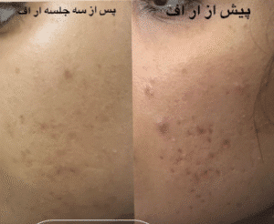 نمونه آر اف صورت دکتر سحر پارسایی