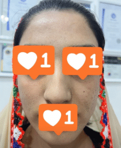 نمونه آر اف صورت دکتر سحر پارسایی