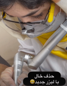 نمونه لیزر فرکشنال دکتر سارا ملکارا