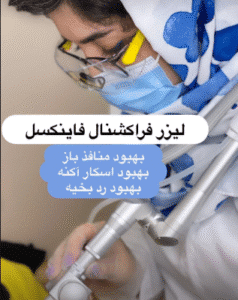 نمونه لیزر فرکشنال دکتر سارا ملکارا