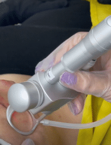 نمونه لیزر فرکشنال دکتر سارا ملکارا