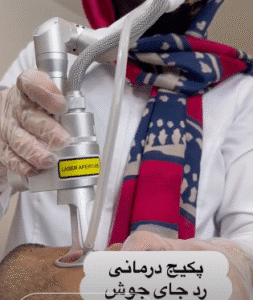 نمونه لیزر فرکشنال دکتر سارا ملکارا