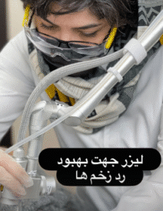 نمونه لیزر فرکشنال دکتر سارا ملکارا
