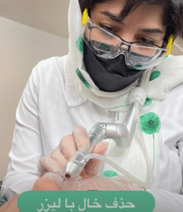 نمونه لیزر فرکشنال دکتر سارا ملکارا