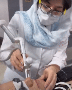 نمونه لیزر فرکشنال دکتر سارا ملکارا