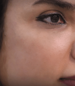 نمونه آر اف کلینیک تخصصی آفرینش