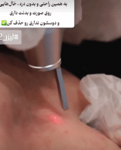 نمونه آر اف کلینیک تخصصی آفرینش