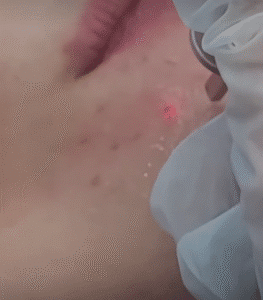 نمونه آر اف کلینیک تخصصی آفرینش