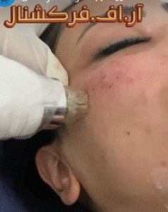 نمونه آر اف فرکشنال دکتر حسین شقایق