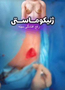 نمونه ژنیکوماستی دکتر حسن طالب زاده
