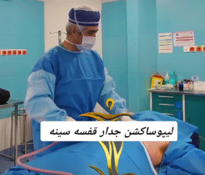 نمونه ژنیکوماستی دکتر حسن طالب زاده