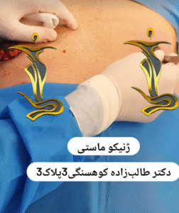 نمونه ژنیکوماستی دکتر حسن طالب زاده