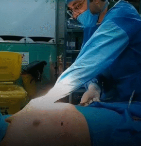 نمونه ژنیکوماستی دکتر سعید کیقبادی