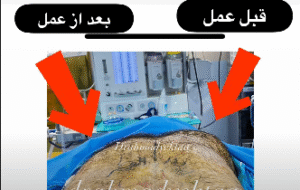 نمونه ژنیکوماستی دکتر احمد یکتا