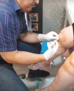 نمونه تزریق مفصل دکتر رضا عرفانی سیار