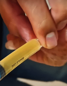 نمونه تزریق مفصل دکتر رضا عرفانی سیار