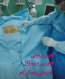 نمونه لیزر درمانی دکتر رضا عرفانی سیار