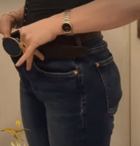 نمونه ابدومینوپلاستی دکتر حسن طالب زاده