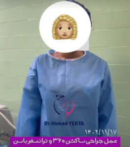 نمونه ابدومینوپلاستی دکتر احمد یکتا
