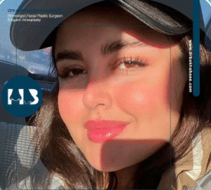 نمونه عمل بینی دکتر مهدی بخشایی