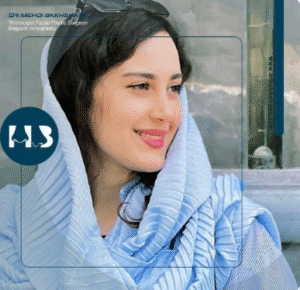 نمونه عمل بینی دکتر مهدی بخشایی