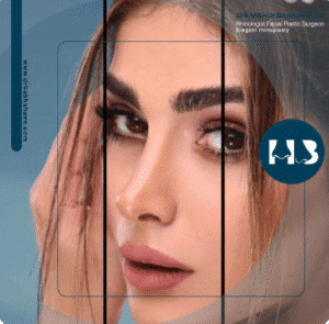 نمونه عمل بینی دکتر مهدی بخشایی