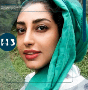 نمونه عمل بینی دکتر مهدی بخشایی