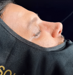 نمونه عمل بینی دکتر بشیر رسولیان