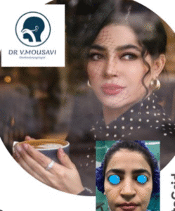 نمونه عمل بینی دکتر وحیده موسوی