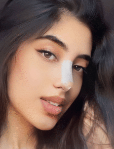 نمونه عمل بینی دکتر محمد اکبریان