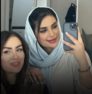 نمونه عمل بینی دکتر محمد اکبریان