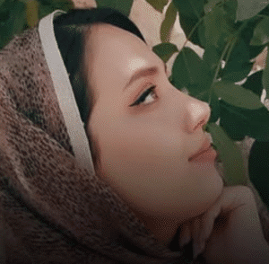 نمونه عمل بینی دکتر محمد اکبریان