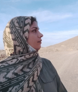 نمونه عمل بینی دکتر محمد اکبریان