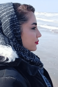 نمونه عمل بینی دکتر محمد اکبریان