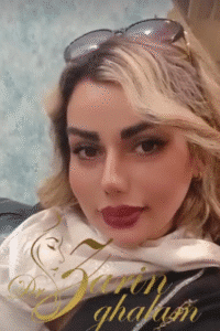 نمونه عمل بینی دکتر محمدعلی زرین قلم