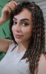 نمونه عمل بینی دکتر محمدعلی زرین قلم