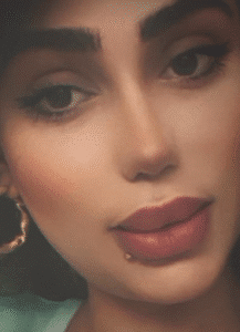 نمونه عمل بینی دکتر محمدعلی زرین قلم