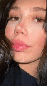 نمونه عمل بینی دکتر محمدعلی زرین قلم